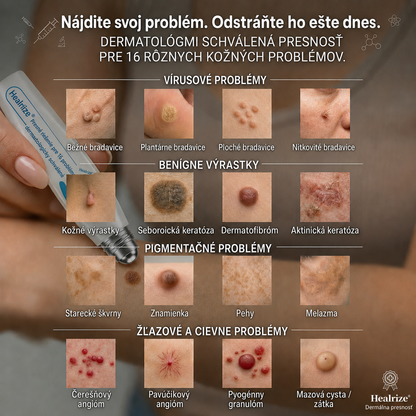 𝐇𝐞𝐚𝐥𝐫𝐢𝐳𝐞® 👩‍⚕️🍉 7-𝑫ň𝒐𝒗ý 𝑵𝒂 𝑶𝒅𝒔𝒕𝒓𝒂ň𝒐𝒗𝒂𝒏𝒊𝒆 𝑷𝒊𝒈𝒎𝒆𝒏𝒕𝒐𝒗ý𝒄𝒉 Š𝒌𝒗ŕ𝒏 𝑨 𝑱𝒂𝒛𝒊𝒆𝒗 𝑷𝒆𝒓𝒐(𝐵𝑒𝑧 𝑏𝑜𝑙𝑒𝑠𝑡𝑖, 𝑏𝑒𝑧 𝑗𝑎𝑧𝑖𝑒𝑣 – 𝑟𝑜𝑙𝑙𝑒𝑟𝑏𝑎𝑙𝑙)📌📌