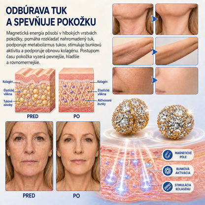 Magnetické náušnice TIMNAMY® z moissanitu na podporu lymfatickej starostlivosti: rýchle výsledky, bez potreby prepichovania uší. Špeciálna ponuka na posledný deň: 50 % zľava 💝💘1