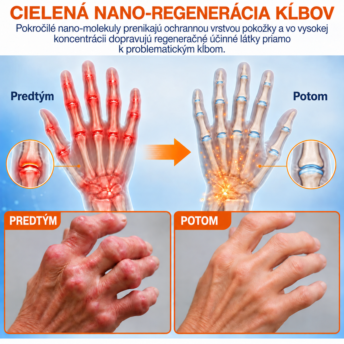 🌍✅ Oficiálny obchod SK: Healrize® Mikroihličková náplasť na úľavu od bolesti a podporu regenerácie kostí (🧑‍⚕️Pomáha zmierniť opuch, bolesť, stuhnutosť, začervenanie, pocit tepla, nepohodlie a únavu kĺbov)🧑‍⚕️🧑‍⚕️
