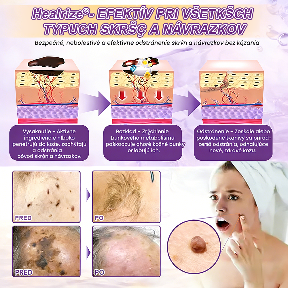 Vyrobené a dodávané na Slovensku ✨Healrize® Biotin 10-in-1 Skin Restoration Cream 🍀