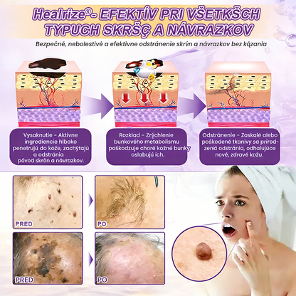 Vyrobené a dodávané na Slovensku ✨Healrize® Biotin 10-in-1 Skin Restoration Cream 🍀