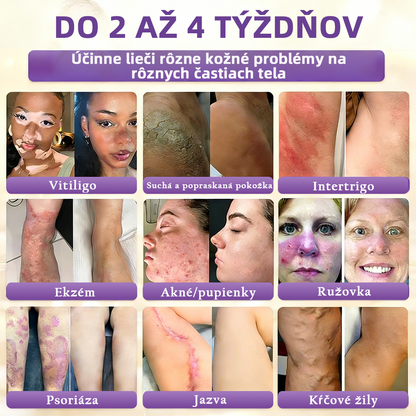Vyrobené a dodávané na Slovensku ✨Healrize® Biotin 10-in-1 Skin Restoration Cream 🍀