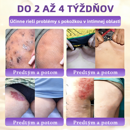 Vyrobené a dodávané na Slovensku ✨Healrize® Biotin 10-in-1 Skin Restoration Cream 🍀