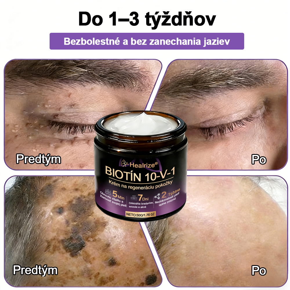 Vyrobené a dodávané na Slovensku ✨Healrize® Biotin 10-in-1 Skin Restoration Cream 🍀