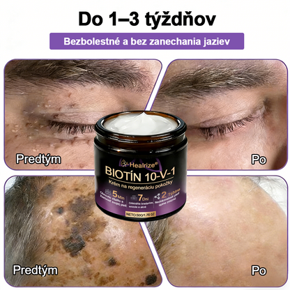 Vyrobené a dodávané na Slovensku ✨Healrize® Biotin 10-in-1 Skin Restoration Cream 🍀