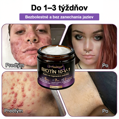 Vyrobené a dodávané na Slovensku ✨Healrize® Biotin 10-in-1 Skin Restoration Cream 🍀