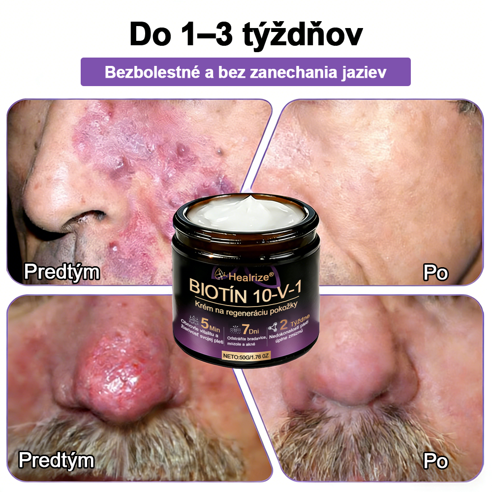 Vyrobené a dodávané na Slovensku ✨Healrize® Biotin 10-in-1 Skin Restoration Cream 🍀