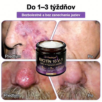 Vyrobené a dodávané na Slovensku ✨Healrize® Biotin 10-in-1 Skin Restoration Cream 🍀