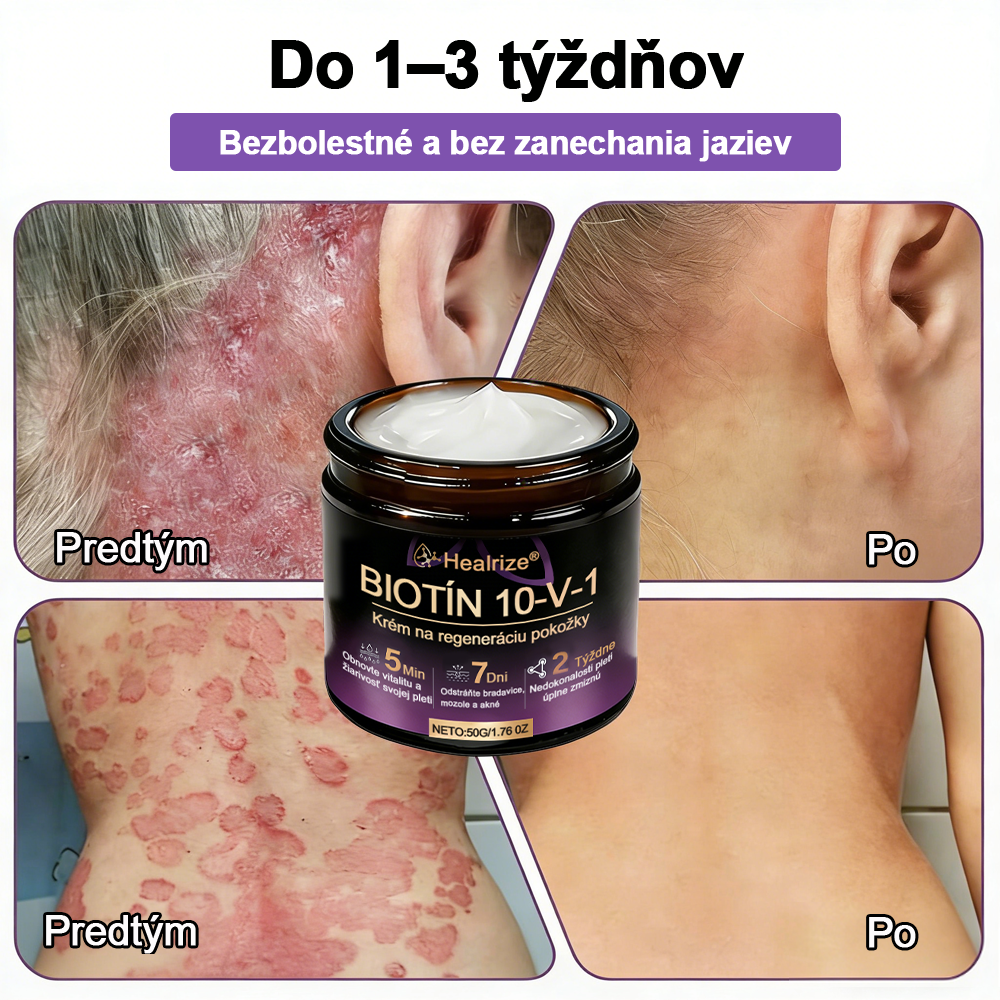 Vyrobené a dodávané na Slovensku ✨Healrize® Biotin 10-in-1 Skin Restoration Cream 🍀