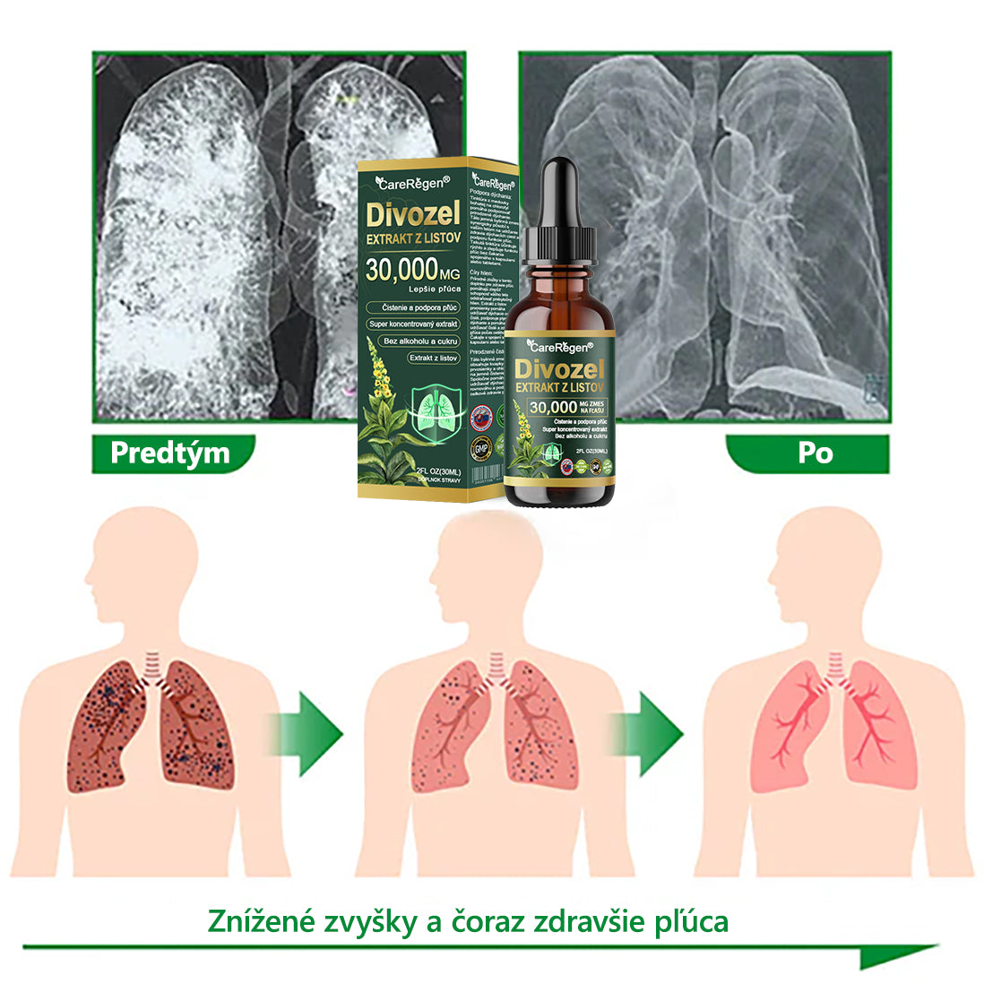 𝗢𝗳𝗶𝗰𝗶𝗮𝗹𝗻ý 𝗼𝗯𝗰𝗵𝗼𝗱: 𝗖𝗮𝗿𝗲𝗥𝗲𝗴𝗲𝗻® Organické kvapky na čistenie pľúc z listov divozelu 🎖️ Klinicky overená, vysoko koncentrovaná formula, ktorá uľavuje od kašľa, hlienu, astmy a CHOCHP — dýchajte ľahšie a rýchlejšie. 🎖️
