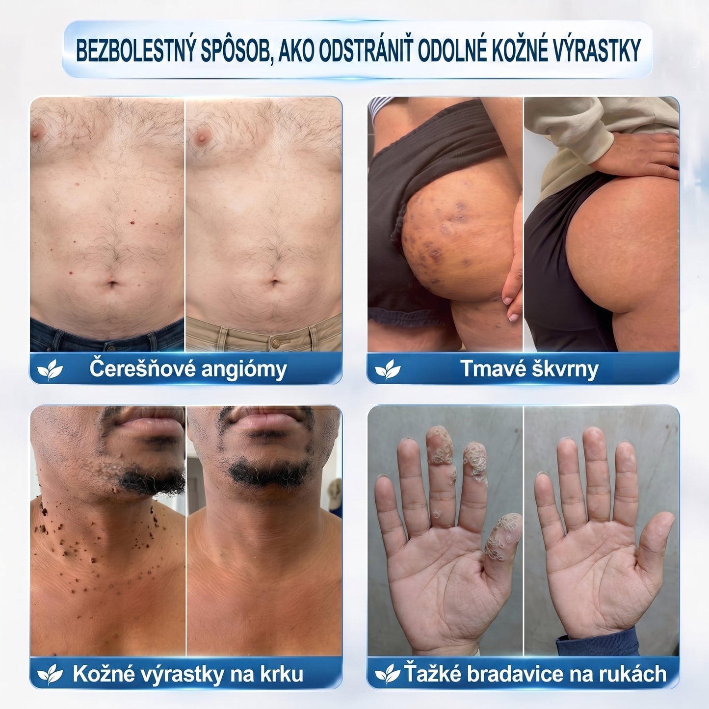 𝐇𝐞𝐚𝐥𝐫𝐢𝐳𝐞® 👩‍⚕️🍉 7-𝑫ň𝒐𝒗ý 𝑵𝒂 𝑶𝒅𝒔𝒕𝒓𝒂ň𝒐𝒗𝒂𝒏𝒊𝒆 𝑷𝒊𝒈𝒎𝒆𝒏𝒕𝒐𝒗ý𝒄𝒉 Š𝒌𝒗ŕ𝒏 𝑨 𝑱𝒂𝒛𝒊𝒆𝒗 𝑷𝒆𝒓𝒐(𝐵𝑒𝑧 𝑏𝑜𝑙𝑒𝑠𝑡𝑖, 𝑏𝑒𝑧 𝑗𝑎𝑧𝑖𝑒𝑣 – 𝑟𝑜𝑙𝑙𝑒𝑟𝑏𝑎𝑙𝑙)📌📌