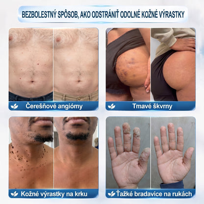 𝐇𝐞𝐚𝐥𝐫𝐢𝐳𝐞® 👩‍⚕️🍉 7-𝑫ň𝒐𝒗ý 𝑵𝒂 𝑶𝒅𝒔𝒕𝒓𝒂ň𝒐𝒗𝒂𝒏𝒊𝒆 𝑷𝒊𝒈𝒎𝒆𝒏𝒕𝒐𝒗ý𝒄𝒉 Š𝒌𝒗ŕ𝒏 𝑨 𝑱𝒂𝒛𝒊𝒆𝒗 𝑷𝒆𝒓𝒐(𝐵𝑒𝑧 𝑏𝑜𝑙𝑒𝑠𝑡𝑖, 𝑏𝑒𝑧 𝑗𝑎𝑧𝑖𝑒𝑣 – 𝑟𝑜𝑙𝑙𝑒𝑟𝑏𝑎𝑙𝑙)📌📌