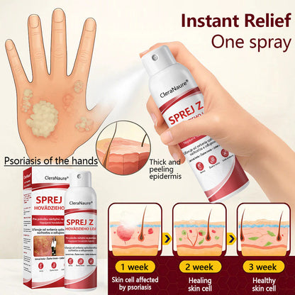 🔴Healrize® Beef Tallow Spray na svrbiacu, olupujúcu pokožku pri psoriáze