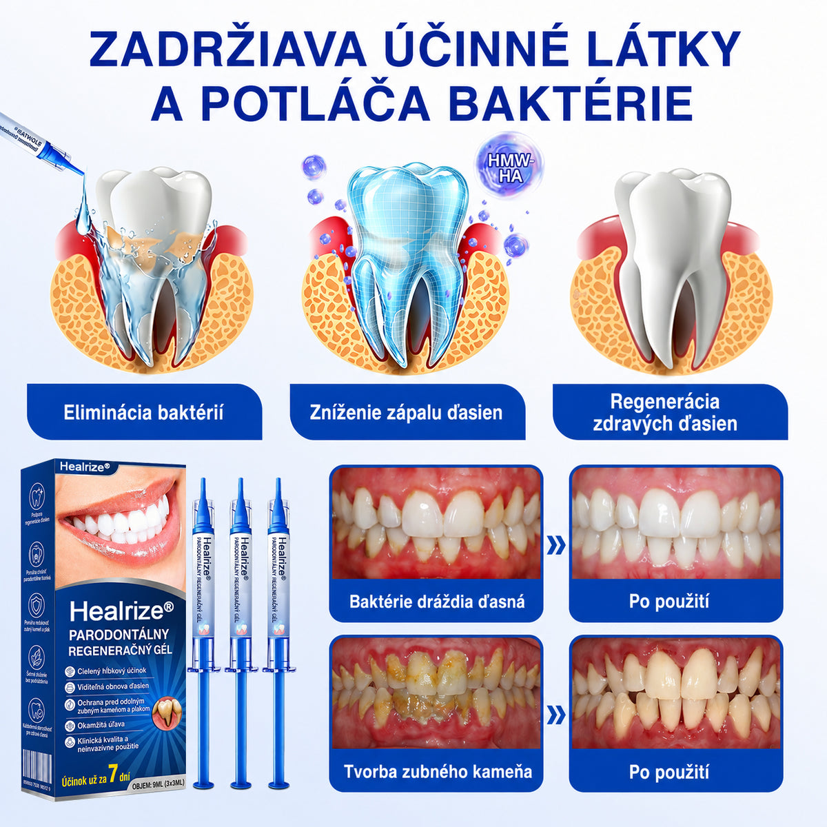 👩‍⚕️🪥🍃🇸🇰🦷𝐇𝐞𝐚𝐥𝐫𝐢𝐳𝐞® GumRevive Parodontálny opravný gél🍃2
