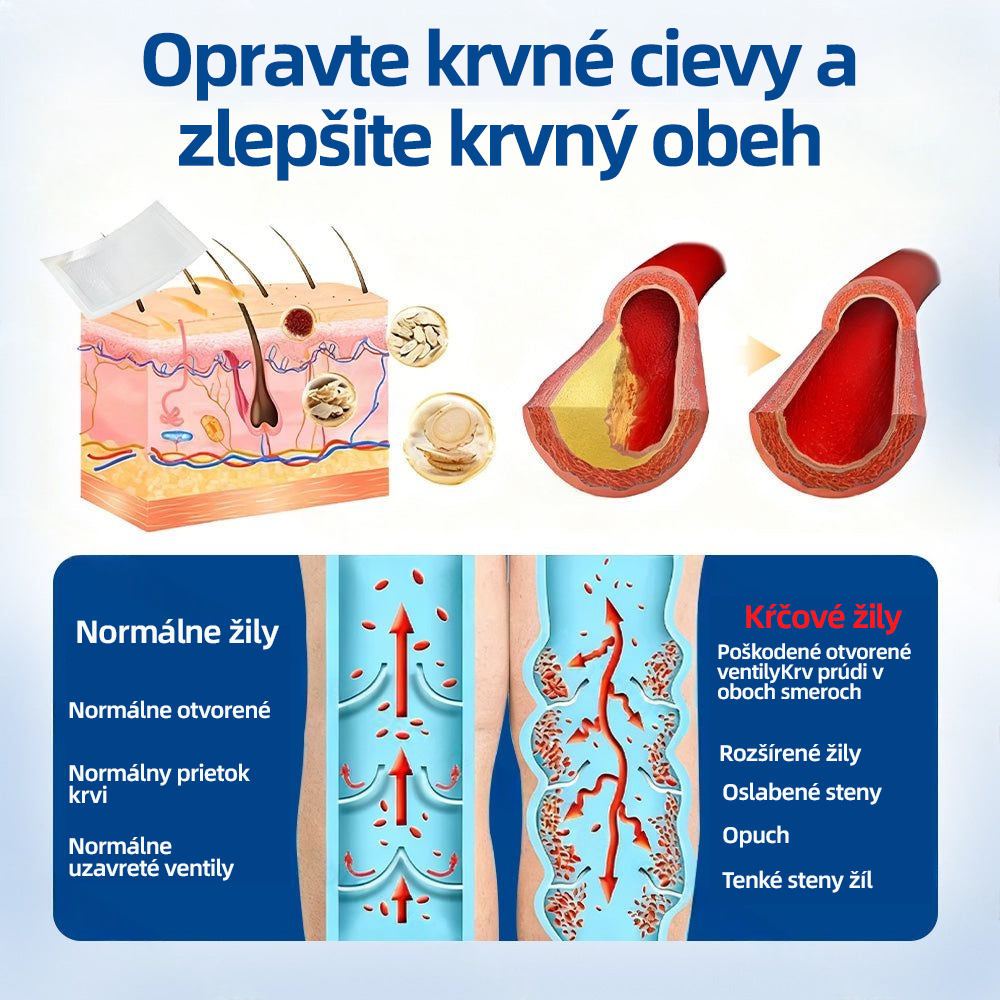 Healrize® VeinTarget Microneedle Patch  Okamžitá úľava, dlhodobé výsledky 🏃‍♂️‍➡️🏃‍♂️‍➡️3
