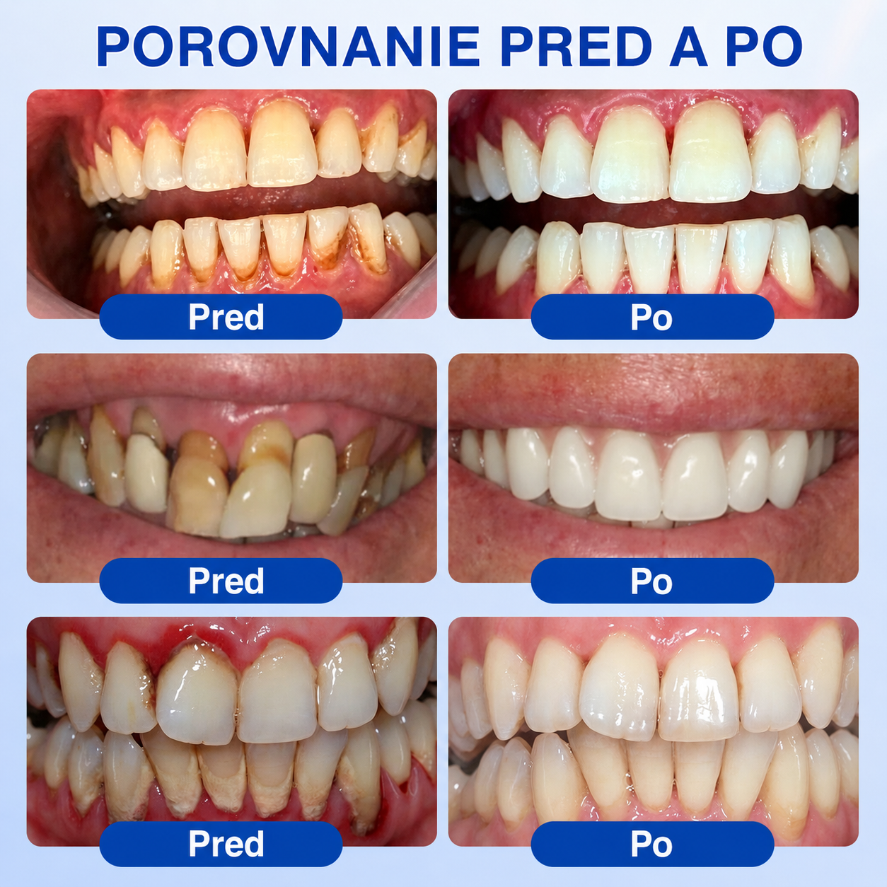 👩‍⚕️🪥🍃🇸🇰🦷𝐇𝐞𝐚𝐥𝐫𝐢𝐳𝐞® GumRevive Parodontálny opravný gél🍃2