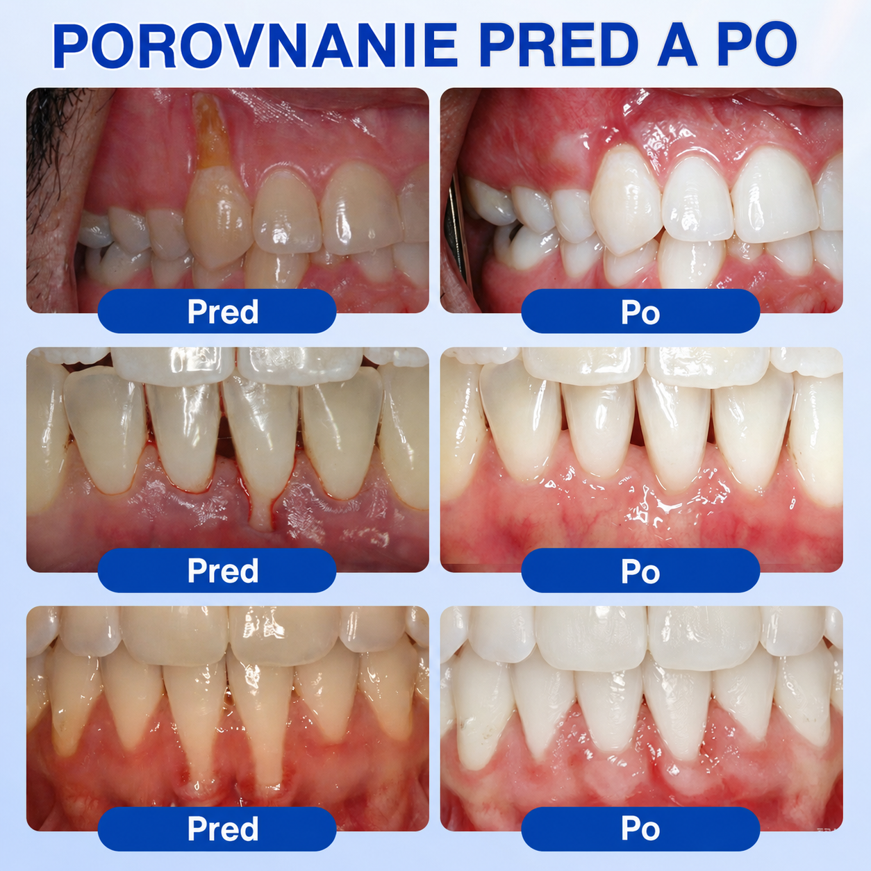👩‍⚕️🪥🍃🇸🇰🦷𝐇𝐞𝐚𝐥𝐫𝐢𝐳𝐞® GumRevive Parodontálny opravný gél🍃2