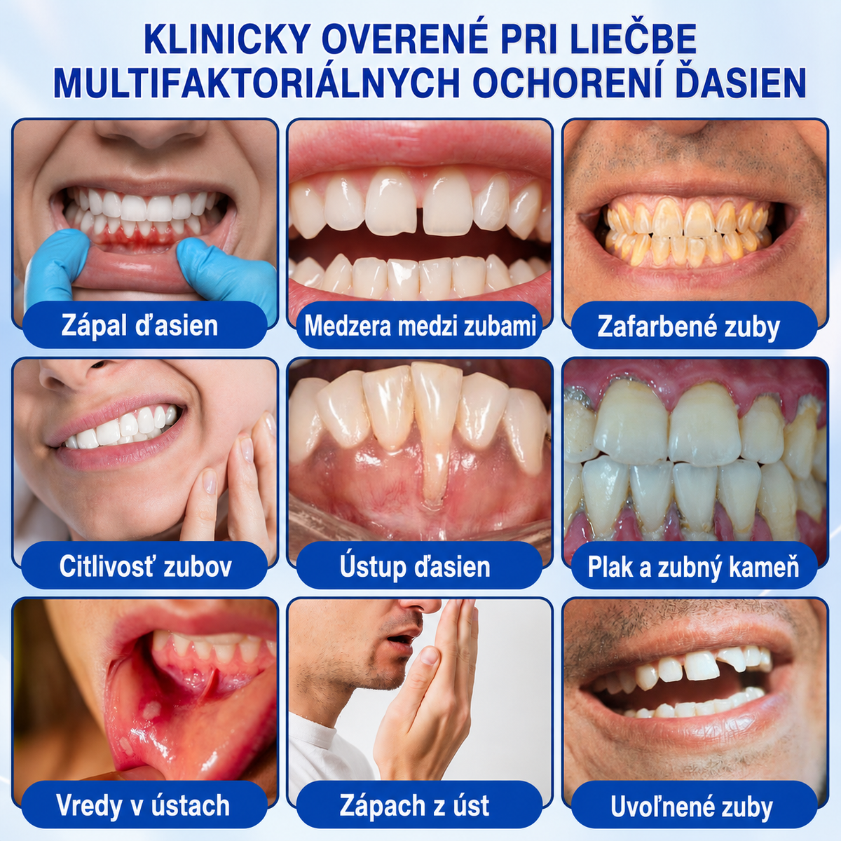 👩‍⚕️🪥🍃🇸🇰🦷𝐇𝐞𝐚𝐥𝐫𝐢𝐳𝐞® GumRevive Parodontálny opravný gél🍃2