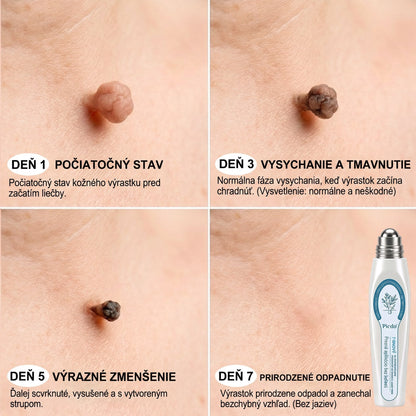 𝐇𝐞𝐚𝐥𝐫𝐢𝐳𝐞® 👩‍⚕️🍉 7-𝑫ň𝒐𝒗ý 𝑵𝒂 𝑶𝒅𝒔𝒕𝒓𝒂ň𝒐𝒗𝒂𝒏𝒊𝒆 𝑷𝒊𝒈𝒎𝒆𝒏𝒕𝒐𝒗ý𝒄𝒉 Š𝒌𝒗ŕ𝒏 𝑨 𝑱𝒂𝒛𝒊𝒆𝒗 𝑷𝒆𝒓𝒐(𝐵𝑒𝑧 𝑏𝑜𝑙𝑒𝑠𝑡𝑖, 𝑏𝑒𝑧 𝑗𝑎𝑧𝑖𝑒𝑣 – 𝑟𝑜𝑙𝑙𝑒𝑟𝑏𝑎𝑙𝑙)📌📌