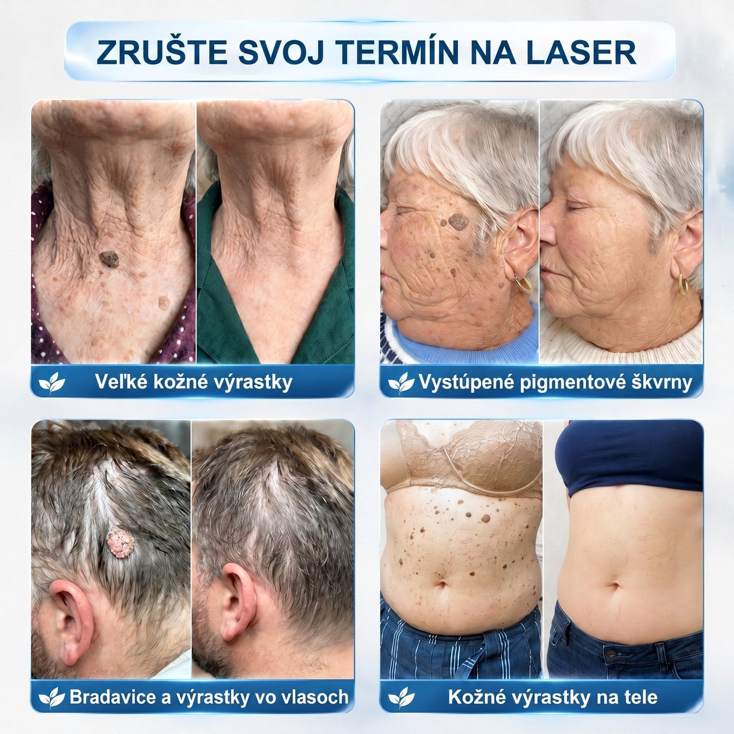 𝐇𝐞𝐚𝐥𝐫𝐢𝐳𝐞® 👩‍⚕️🍉 7-𝑫ň𝒐𝒗ý 𝑵𝒂 𝑶𝒅𝒔𝒕𝒓𝒂ň𝒐𝒗𝒂𝒏𝒊𝒆 𝑷𝒊𝒈𝒎𝒆𝒏𝒕𝒐𝒗ý𝒄𝒉 Š𝒌𝒗ŕ𝒏 𝑨 𝑱𝒂𝒛𝒊𝒆𝒗 𝑷𝒆𝒓𝒐(𝐵𝑒𝑧 𝑏𝑜𝑙𝑒𝑠𝑡𝑖, 𝑏𝑒𝑧 𝑗𝑎𝑧𝑖𝑒𝑣 – 𝑟𝑜𝑙𝑙𝑒𝑟𝑏𝑎𝑙𝑙)📌📌